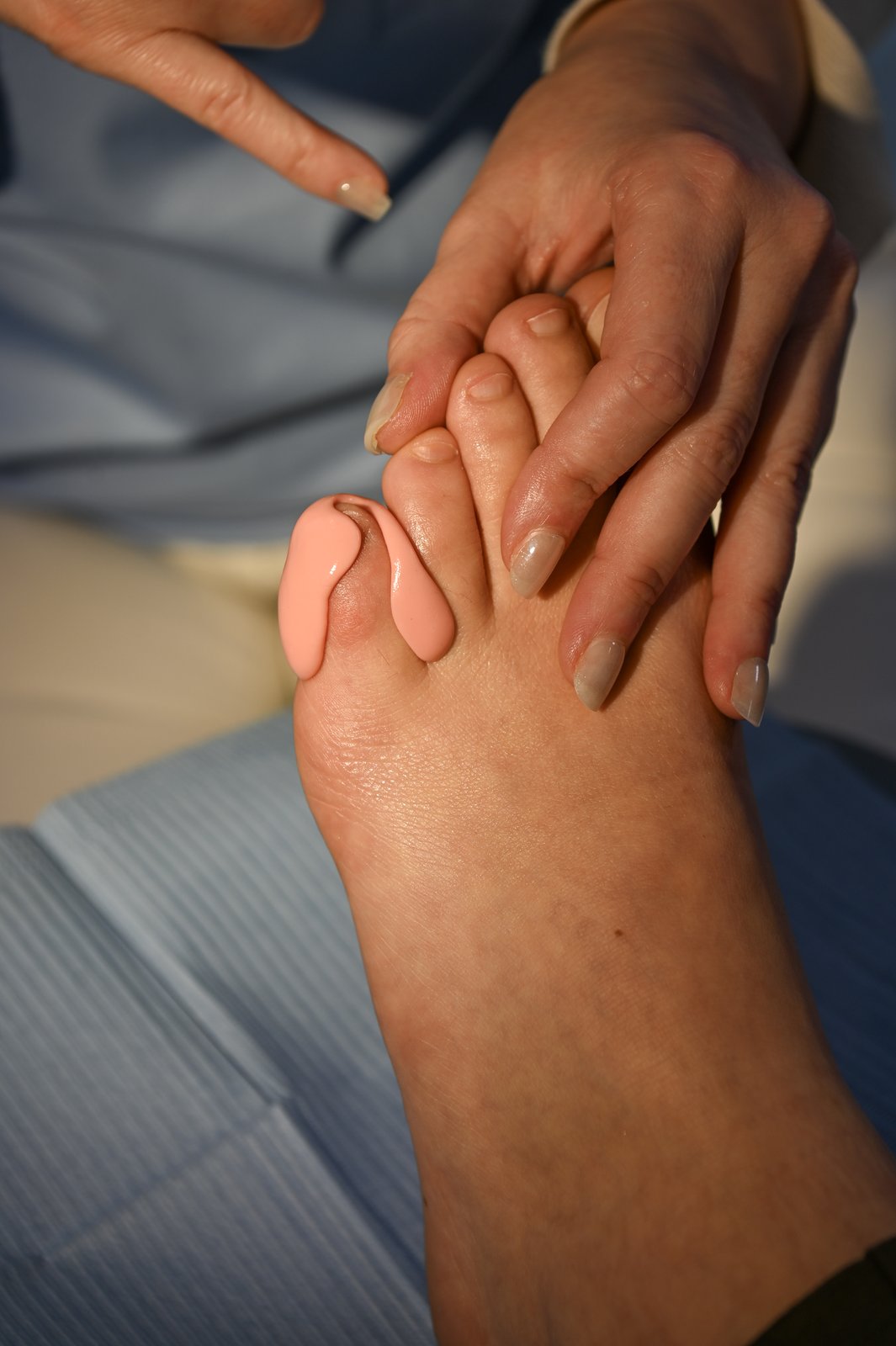 Orthoplastie à La Clinique du Pied